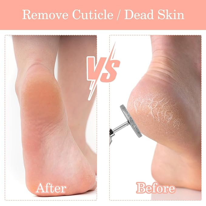 JIEYAO 2 Pcs Sanding Disc Nail Drill Bits, Flat Nail Drill Bits, Electric Foot File Replacement Head Hard Skin Remover Discs Foot Callus Removal Pedicure Supplies for Nail Salon Foot Care