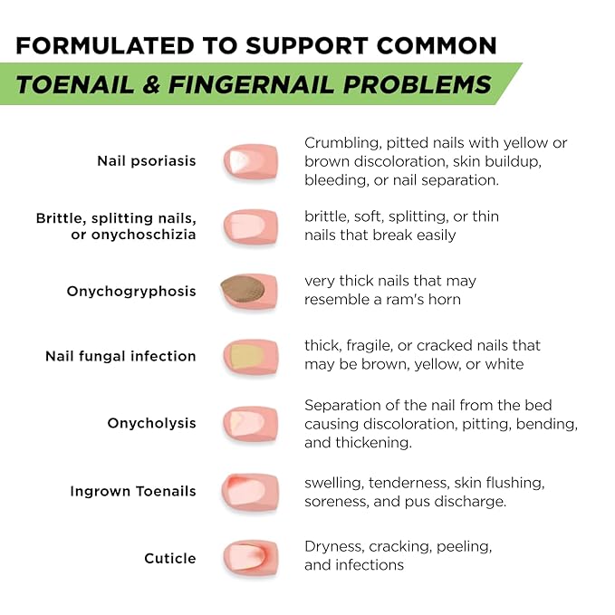 Footcure Antifungal Nail Treatment Pen – Extra Strength Toenail Fungus Treatment, 25% Undecylenic Acid for Toenails & Fingernails, Nail Fungus Repair Pen with Tea Tree & Oregano Oil, Made in USA