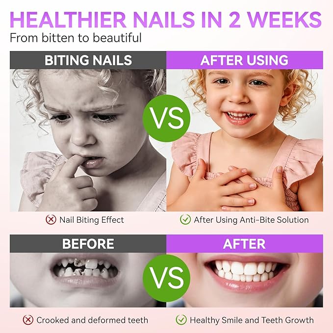 Gelike ec Stop Kids Nail Biting: Strong Extra Bitter Polish for Children - Safe Non Toxic Japanese Vegan Organic Formula to Stop Nail Biting & Thumb Sucking - Long Lasting Clear Treatment
