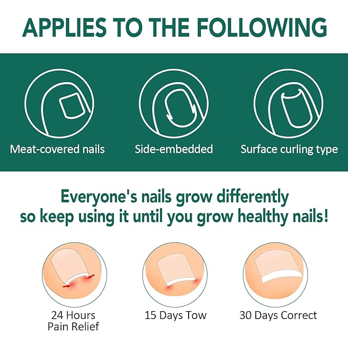 Ingrown Toenail Treatment, 100 Pcs Breathable Ingrown Toenail Strips, Toenail Corrector Patch with 3 Pedicure Tools for At-Home Pedicure and Foot Care (Style 04)