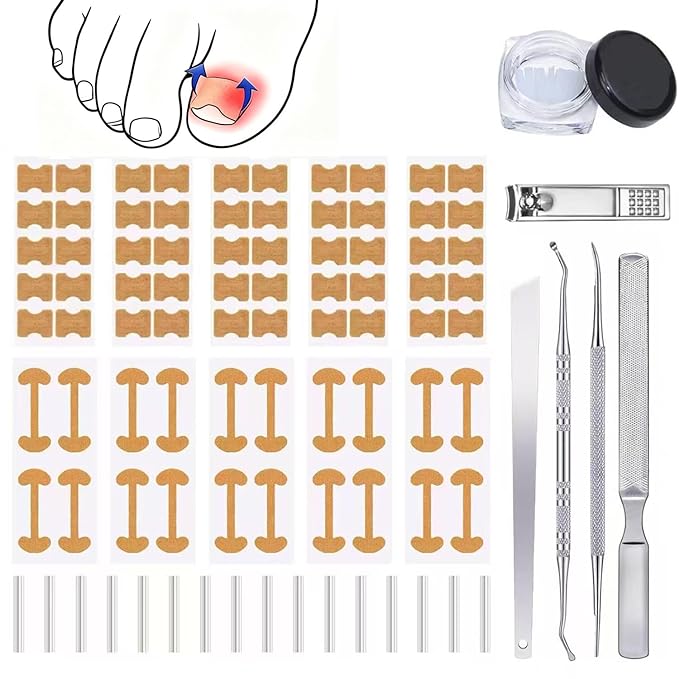 Ingrown Toenail Corrector Set with Correction Strips,Professional Ingrown Toenail Tool kit,Curved Toenails Corrector Patch,For Home Pedicure Care