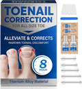 Ingrown Toenail Treatment, Toenail Correction Strips for Curved or Ingrown Nails, Quick Relief, Nail Correction, 5 Different Sizes
