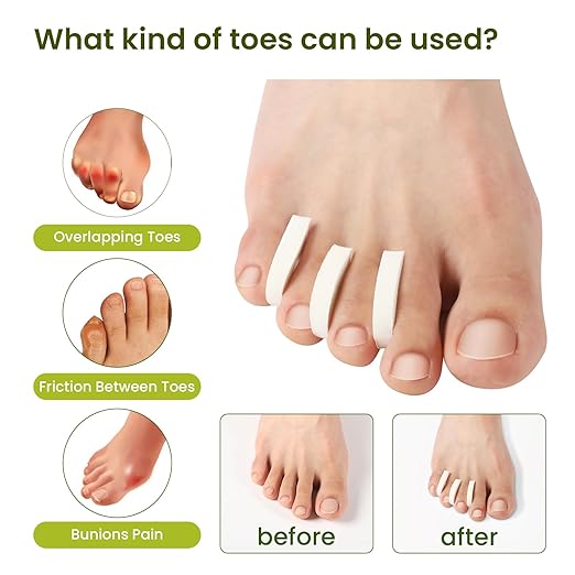 Bukihome 44-Pack Foam Toe Separators – Soft & Breathable Toe Spacers for Women & men, Help Align Overlapping Toes, Relieve Friction & Pressure, Ideal for Daily Comfort