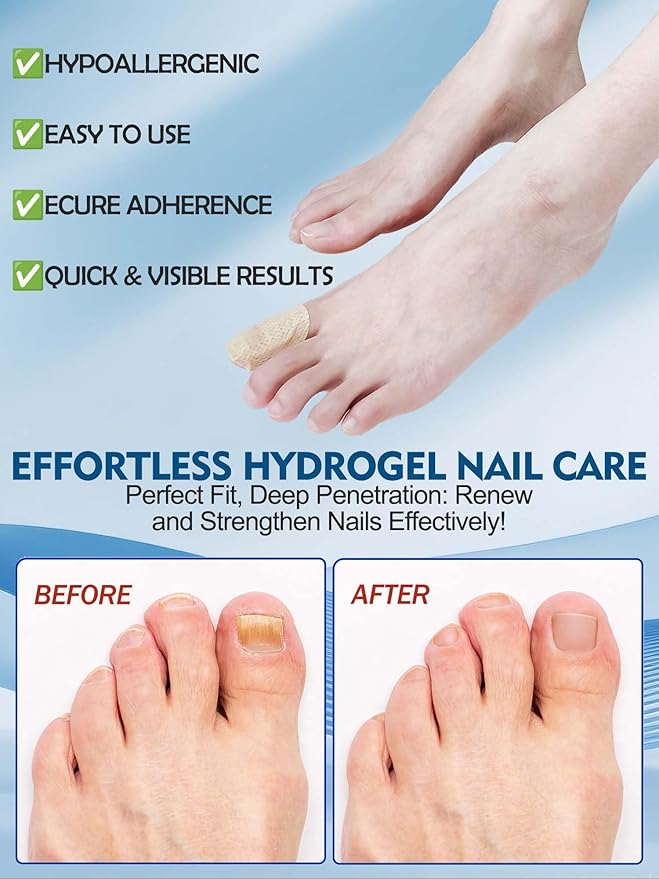Nail Patches Toenail Treatment Extra Strength 8-Hour Overnight Nail Fast Acting Repair Effortless Hydrogel Nail Care and Repair for Damaged Nails Overnight Renewal for Men and Women (24, Medium)
