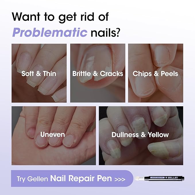 Gellen Nail Strengthener for Damaged Nails, 30s Fast Absorbing Triple Protein Nail Repair Complex, Keratin Nail Treatment Pen, Prevents Peeling & Ridges, Growth Hardener with Sponge Tip, Gift for Her