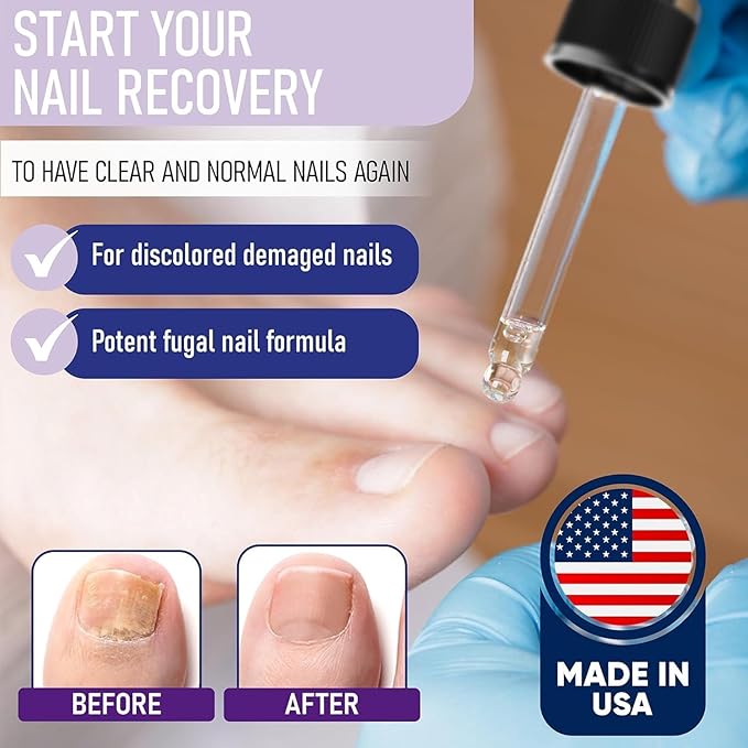 Nail Repair For Damaged Nails - Clinically Proven for Discolored, Thick, Brittle, Yellow, Lifted, and other signs of Fungus-Damaged Toenails - 92% of Nail Repair Improvement | Packaging May Vary