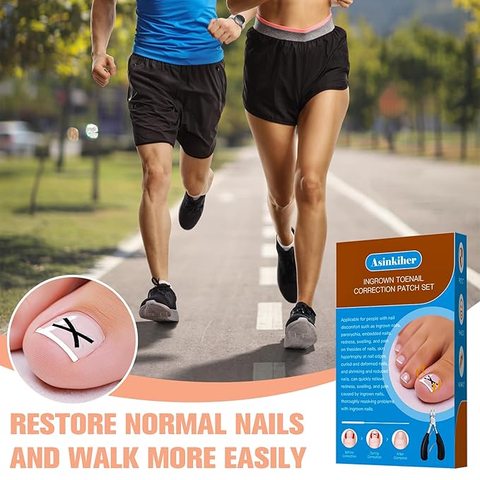 Ingrown Toenail Treatment Kit – Upgraded X-Type Titanium Alloy Corrector for Big Toe Relief, At Home Ingrown Toenail Removal Tool with Clippers and Braces
