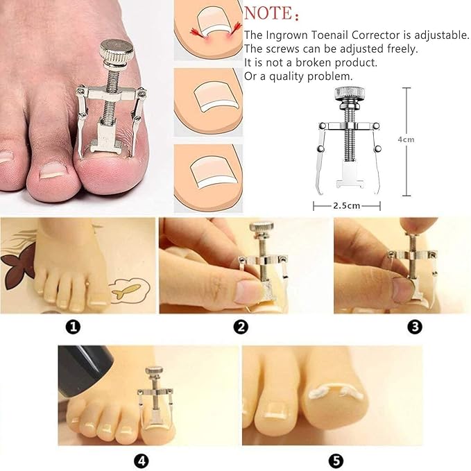 JTIEO 9PACK Toenail Clippers Ingrown Toenail Tool Ingrown Toenail Treatment Ingrown Toenail Tool Kit Stainless Steel Ingrown Toenail Removal Kit Professional Tool Set for Ingrown & Thick Nail Blue