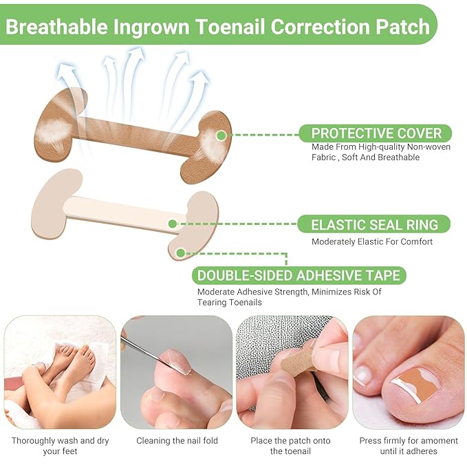 Ingrown Toenail Corrector Set with Correction Strips, Professional Toenail Tool Kit Includes Breathable Toenail Strips, Ingrown Toenails Pedicure Tool Set for Home Use (Silvery)