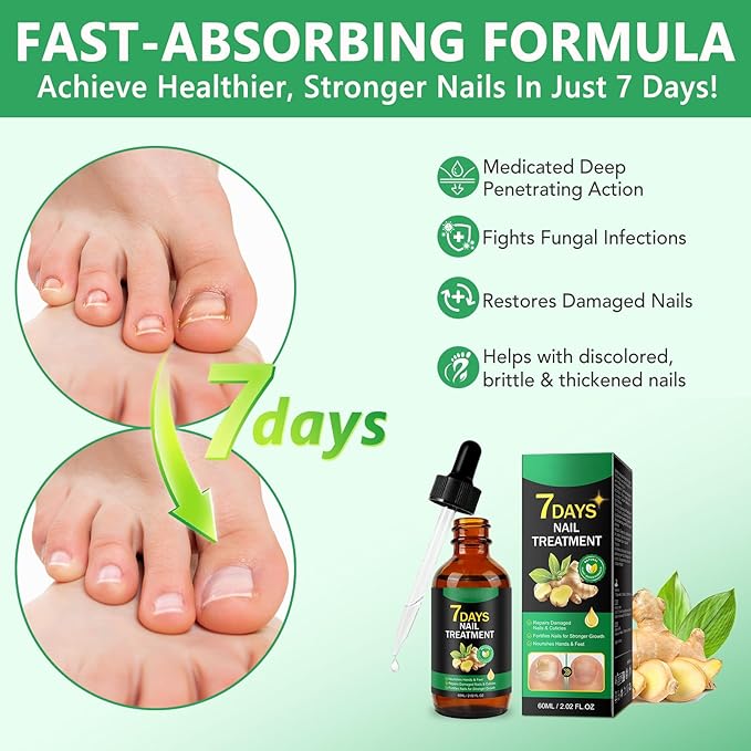 Ginger Nail Growth Serum,Ginger Cuticle Care Oil for Strengthen & Promote Nails Growth, Natural Plant Formula
