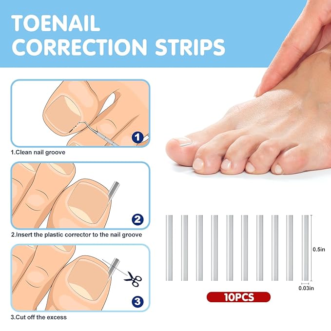 Ingrown Toenail Removal Kit, Professional Ingrown Toenail Treatment Includes Ingrown Toenail Corrector, Tweezer, 50pcs Corrector Patches, 12 Toenail Braces, 10 Ingrown Toenail Corrector Strips