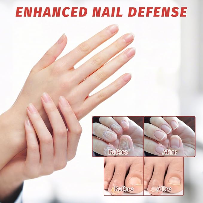 30 Pcs Extra Strength Nail Repair Patches - Overnight Renewal for Damaged, Discolored & Thickened Toenails & Fingernails for Men and Women