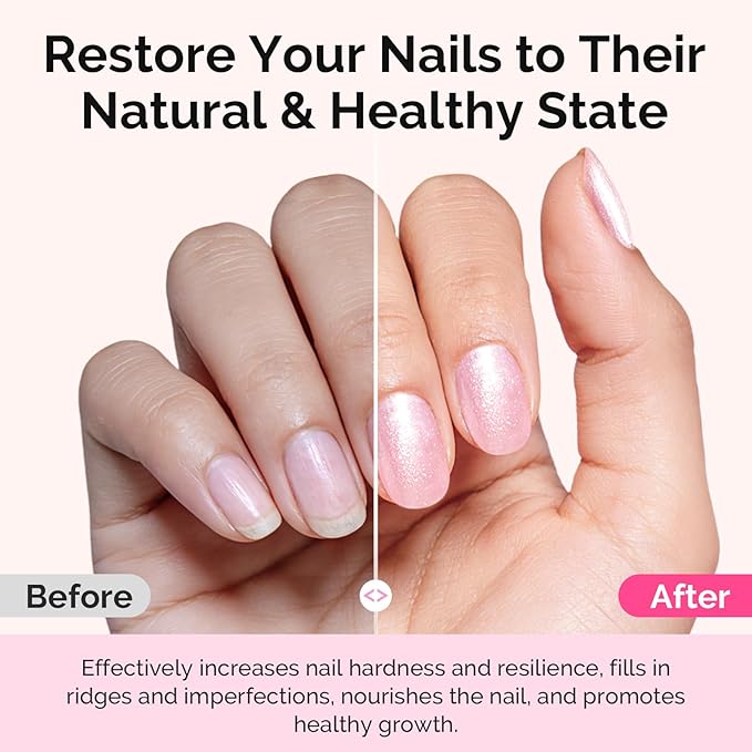 MelodySusie Nail Strengthener and Growth Treatment, 2-in-1 Ridge Filling Base Coat & Glossy Concealer Polish for Damaged Nail Repair and Healthy Shine,Gifts for Women 15ml 0.5 Fl Oz Sparkling Pink