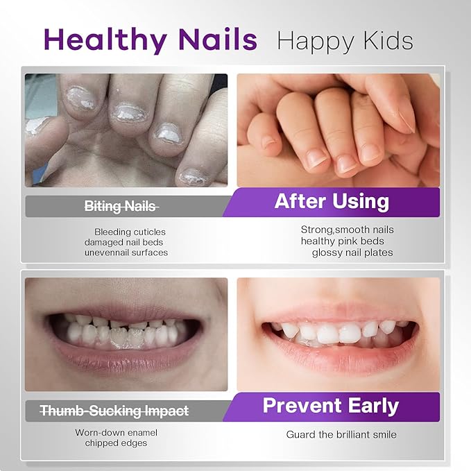 Stop Nail Biting Polish Extra Strength Formula Upgraded Bitterness Effective Anti-Biting Treatment for Adults Kids Bitter Nail Deterrent to End Thumb Sucking Water Resistant & Long Lasting
