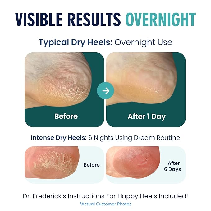 Dr. Frederick's Original Moisturizing Heel Socks for Dry Cracked Heels Treatment - Infused with Olive Oil, Jojoba Oil and Vitamin E - 2 Pairs - Valentines Day Gifts for Her & Him - Green Aloe