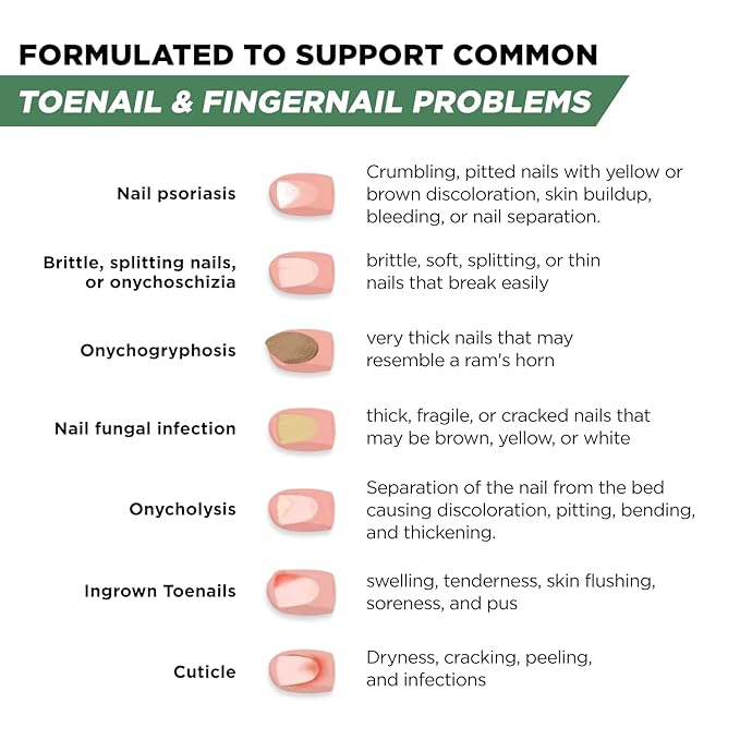 Toenail Renewal Solution Extra Strength Care for Toe Nail & Fingernails - Nail Repair Solution for broken, Discolored Nails - Renews Damaged Cracked Ingrown Toenail Made In USA 0.50 Fl Oz - 2 Pack