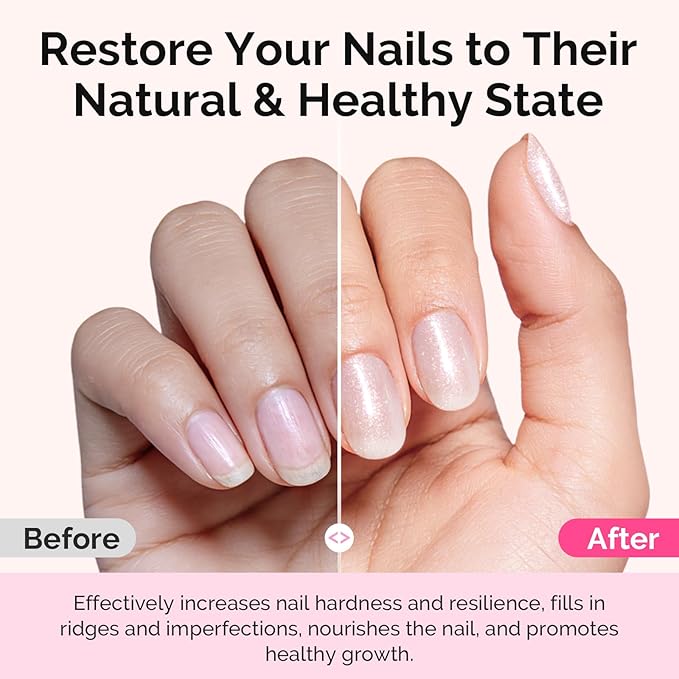 MelodySusie Nail Strengthener and Growth Treatment, 2-in-1 Ridge Filling Base Coat & Glossy Concealer Polish for Damaged Nail Repair and Healthy Shine,Gifts for Women 15ml 0.5 Fl Oz Sparkling White