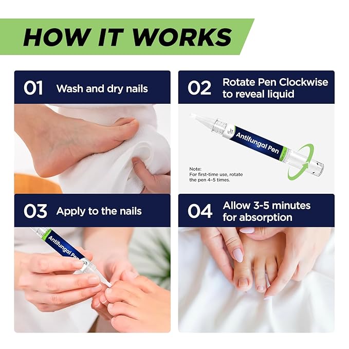 Footcure Antifungal Nail Treatment Pen – Extra Strength Toenail Fungus Treatment, 25% Undecylenic Acid for Toenails & Fingernails, Nail Fungus Repair Pen with Tea Tree & Oregano Oil, Made in USA