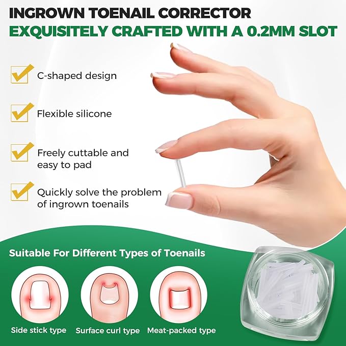 Ingrown Toenail Kit - Ingrown Toenail Drops, Ingrown Toenail Set - 60 Pcs Toenail Straightener Strips -Toenail Lifter Small Scissors