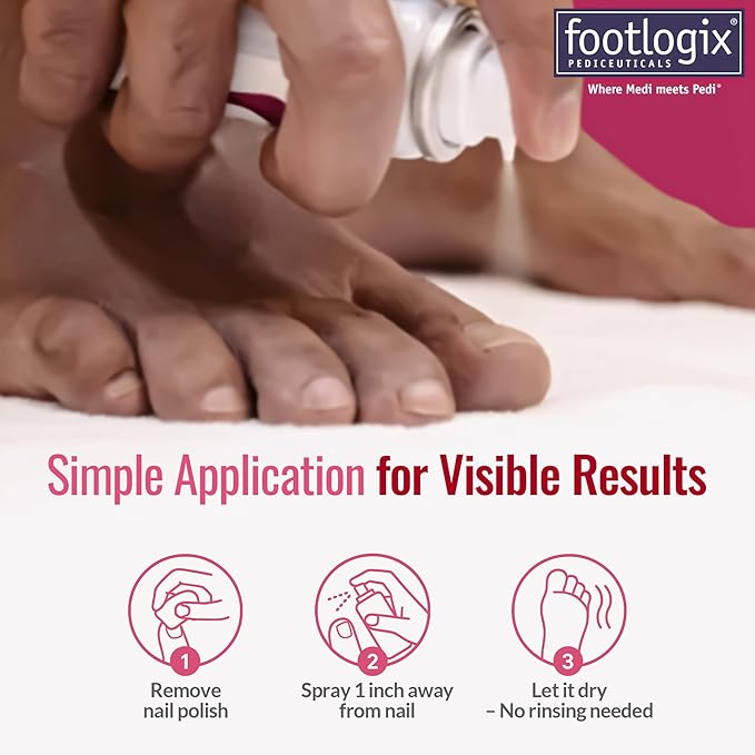 FOOTLOGIX Nail Tincture Spray with Spiraleen, 1.55 Fl Oz (Pack of 1)