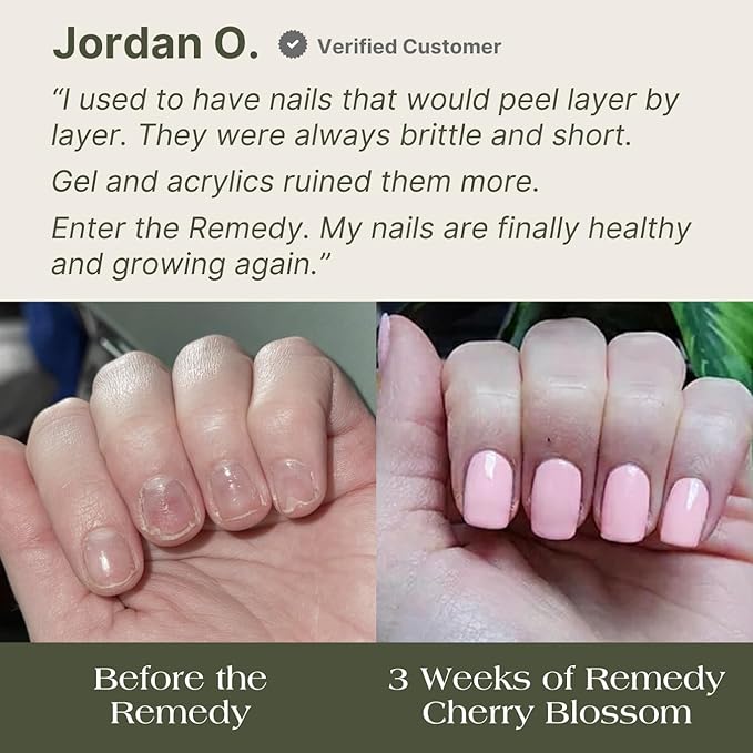 Botanist Nail Rescue Kit | Strengthening Polish + Growth Serum | Grow and Strengthen Nails Damaged from Acrylics, Dip, and Gel Manicures | Non-Toxic, 84% Plant Based, 21-Free & Vegan (Cherry Blossom)