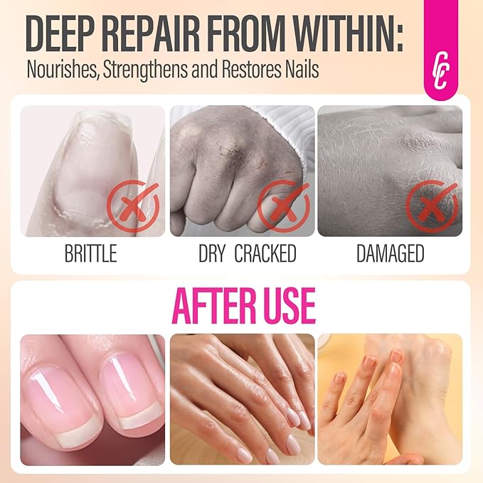 Nail Growth and Strengthening Serum for Cuticle Repair: Natural Plant Protein and Biotin Moisturizing Treatment - Nail Cuticle Care for Dry Weak, Brittle, Splitting Nails