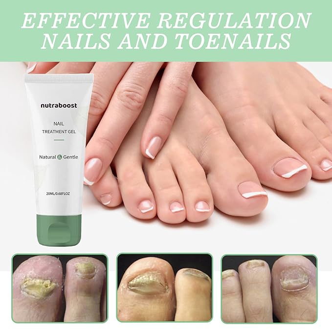 Treatment Gel, Nail Growth Serum for Repair & Strengthener, Multi-Purpose Nail Repair Oil Serum, Foot Care Cream(1pcs)