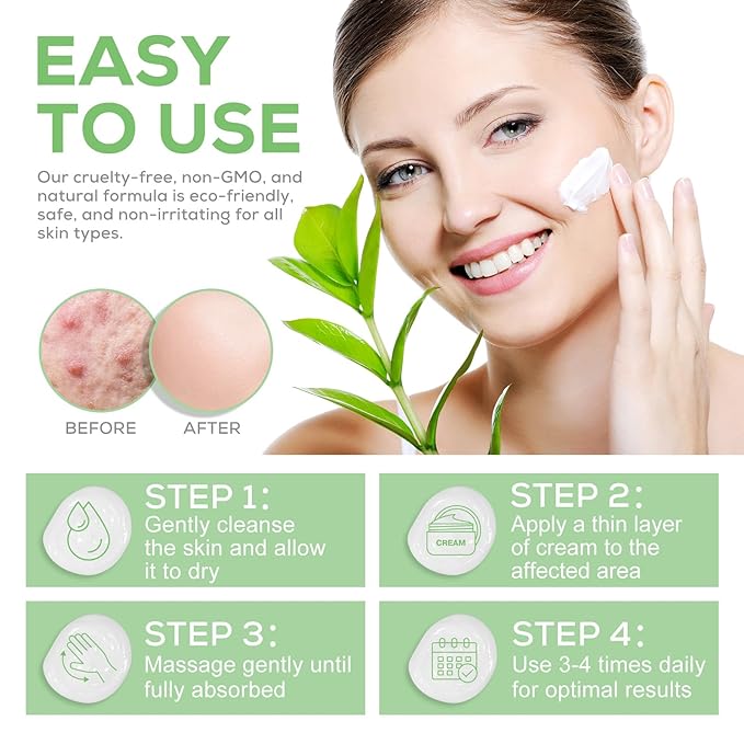 Urea Cream 40 Percent for Feet, plus 2 Percent Salicylic Acid - for Rough Thick Dry & Cracked Skin - Gently Exfoliates - Feet Hands Elbows - Tea Tree, Aloe Vera - 5.29 Oz(150g)
