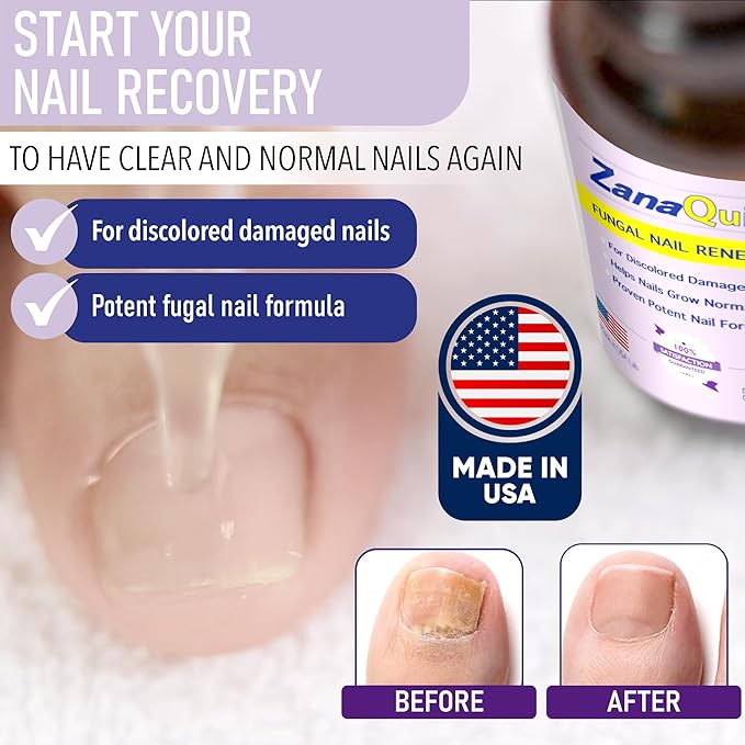 ZanaQuick 2-Step Nail Renewal System - Extra Strength Nail Care Solution & Renewal Drops - Care Kit for Discolored, Brittle Nails