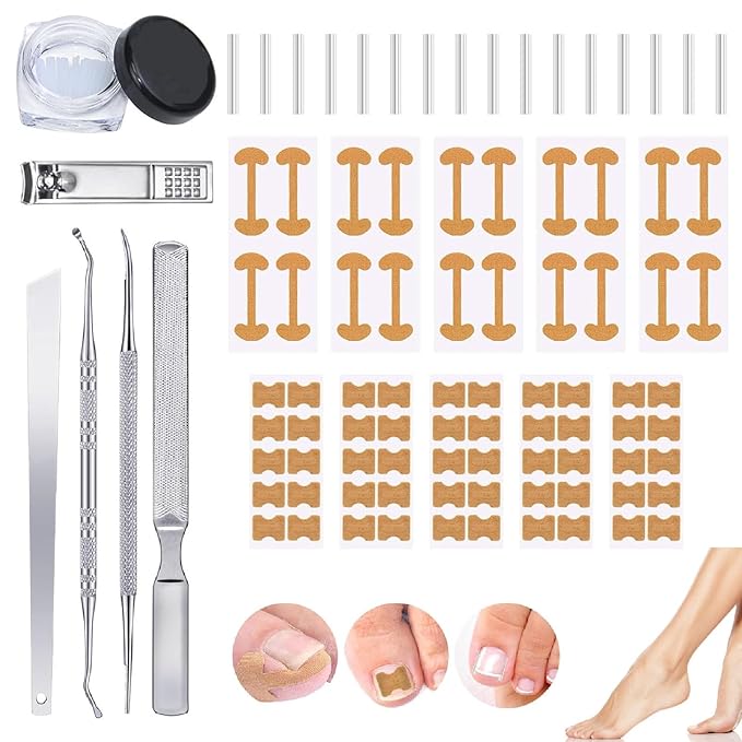 Professional Ingrown Toenail Set with Breathable Ingrown Toenail Strips,Toenail Correction Strips, Curved Toenails Corrector Patch, Painless File and Lifter Pedicure Tools