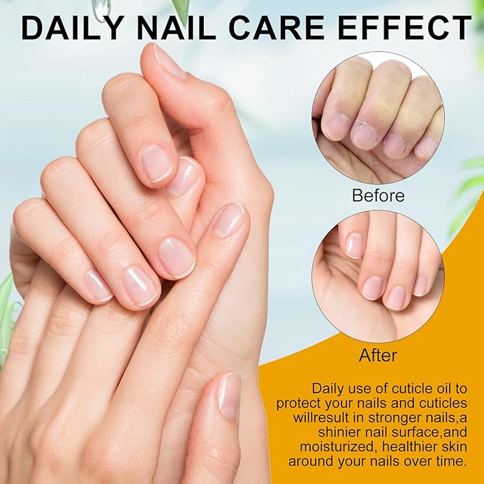 NXJ INFILILA Natural Cuticle Oil for Nails, Deep Hydrating Nail Honey with Vitamin E for Dry Cracked Cuticles and Nails, Growth and Strength Nail Care Product (Milk & Honey)