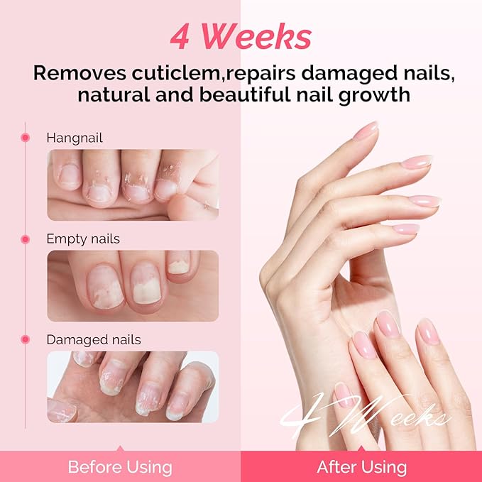 MelodySusie 10ML Cuticle Care Kit - Cuticle Oil and Cuticle Remover, Cuticle Nourishes and Softener, Promotes Nail Growth and Strength for Home and Salon Use 2PCS