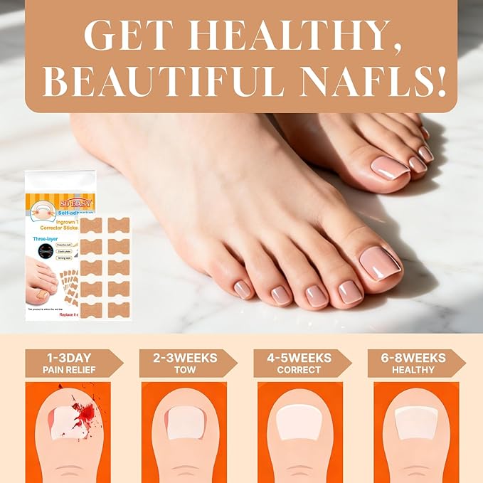 Ingrown Toenail Treatment Strips, 80Pcs Breathable Glue-Free Ingrown Toenail Corrector Patches with File, Professional Non-Slip Toenail Care Tools