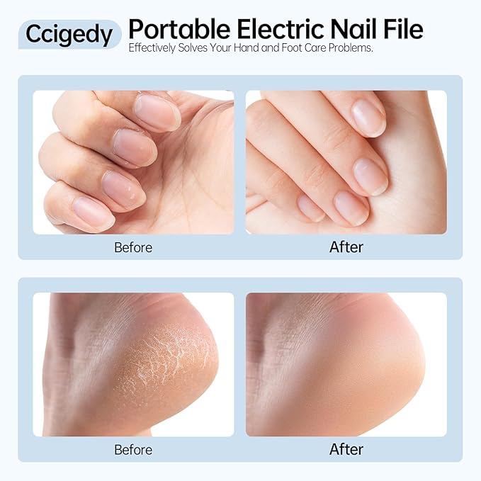 Electric Nail Drill Kit, Electric Nail File Cordless Nail Drill Machine for Acrylic Gel Dip Powder Nails, Professional Portable Manicure Pedicure Rechargeable Lightweight for Home Salon Use