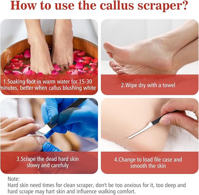 cobee 6 Pcs Ingrown Toenail Removal Kit, Callus Shaver Ingrown Toenail Tool with A Storage Box, Foot Callus Remover Tool Pedicure Knife for Foot Care Dead Skin Corn File Rasp