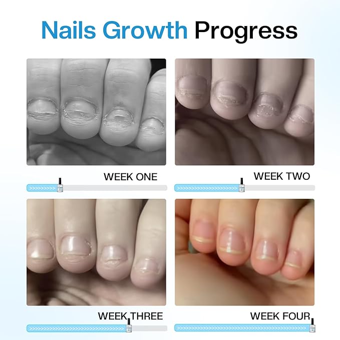Nail Biting Treatment For kids Thumb Sucking Deterrent: No Bite Nail Polish Nail Biting Prevention Safe Bitter Nail Polish For Nail Biters Kids Stop Biting For Adults Quick Dry Lasting