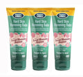 Dermatonics 10% Urea Callus Removing Cream – Removes Hard Skin, Moisturizes and Rehydrates Racked, Rough, Dead and Dry Skin – for Feet, Elbows, and Hands, 2.37 fl oz. Tube, 3 Pack