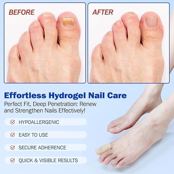 Nail Treatment Patches, 21 Pcs Discolored Thickened Nails Repair, 8 Hour Nightime Nail Renewal Waterproof for men women
