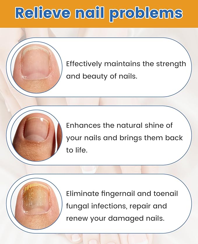 Nail TreatmentFungal Nail Patches For Toenails 32patches, Restore The Nails’ Natural Strength And Clarity.