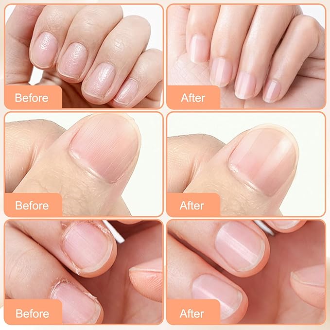 2PCS Nail & Toenail Care Cream, Toenail Nail Repair for Damaged, Strength & Nail Growth Tea Tree Oil, Oregano Oil, Vitamin E, Natural Formula