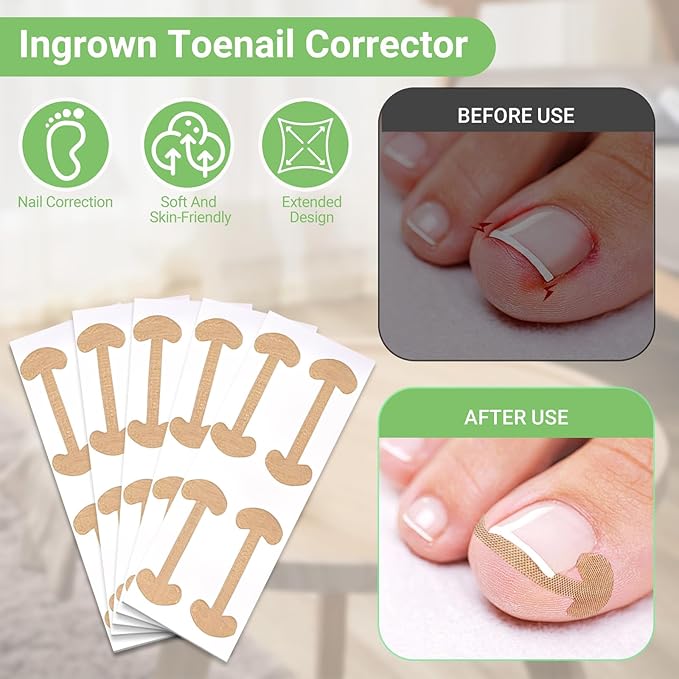 Ingrown Toenail Corrector Set with Correction Strips, Professional Toenail Tool Kit Includes Breathable Toenail Strips, Ingrown Toenails Pedicure Tool Set for Home Use (Silvery)