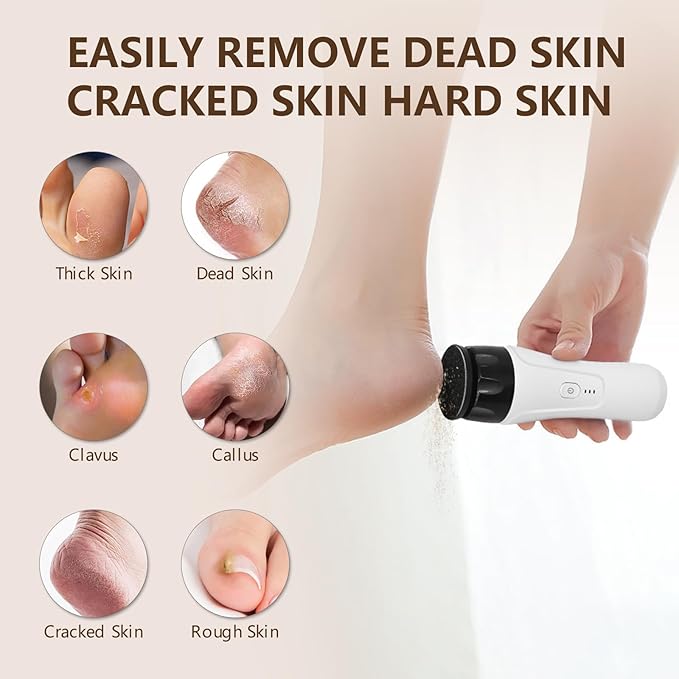 Rechargeable Callus Remover for Feet High Speed, Powerful Electric Foot Sander Heel Grinder Pedicure Tools for Feet Women Men Dead Dry Hard Skin Calluses
