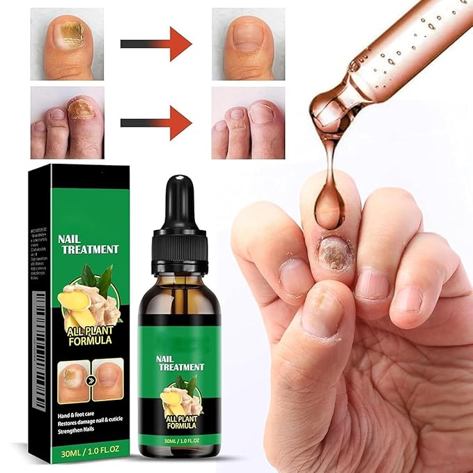 Ginger Nail Growth Strengthener Serum: Ginger-Infused Nail Repair Oil for Care, Natural Nail and Strengthener Solution