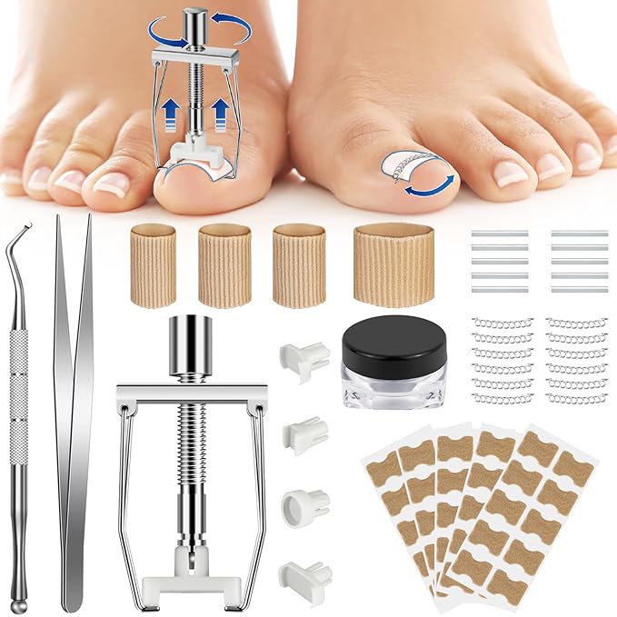 Ingrown Toenail Removal Kit, Professional Ingrown Toenail Treatment Includes Ingrown Toenail Corrector, Tweezer, 50pcs Corrector Patches, 12 Toenail Braces, 10 Ingrown Toenail Corrector Strips