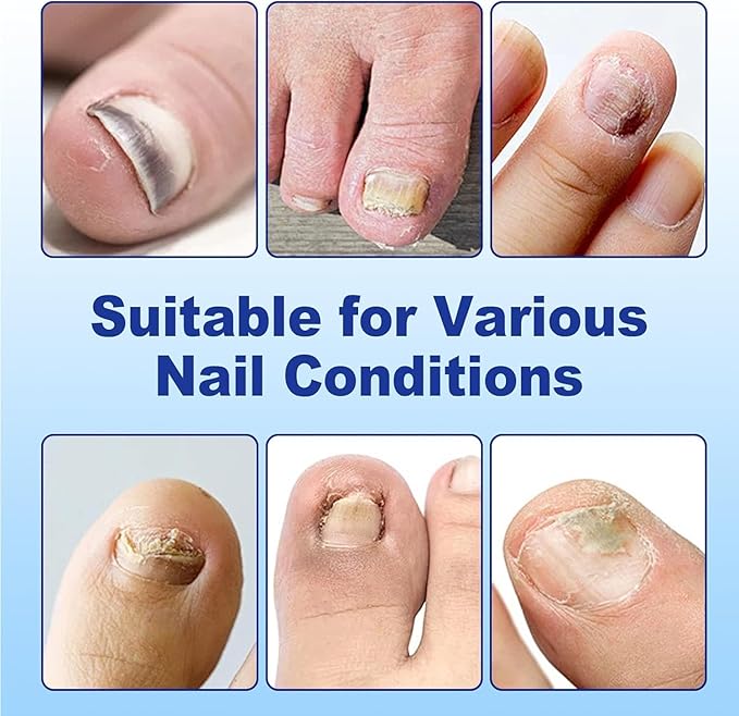 Nail Patches for Toenails- 2Pack, Toenail Stickers Feet, 8-Hour Overnight Nail Patches Fits Large and Small Nails, 42 Count (Blue A)