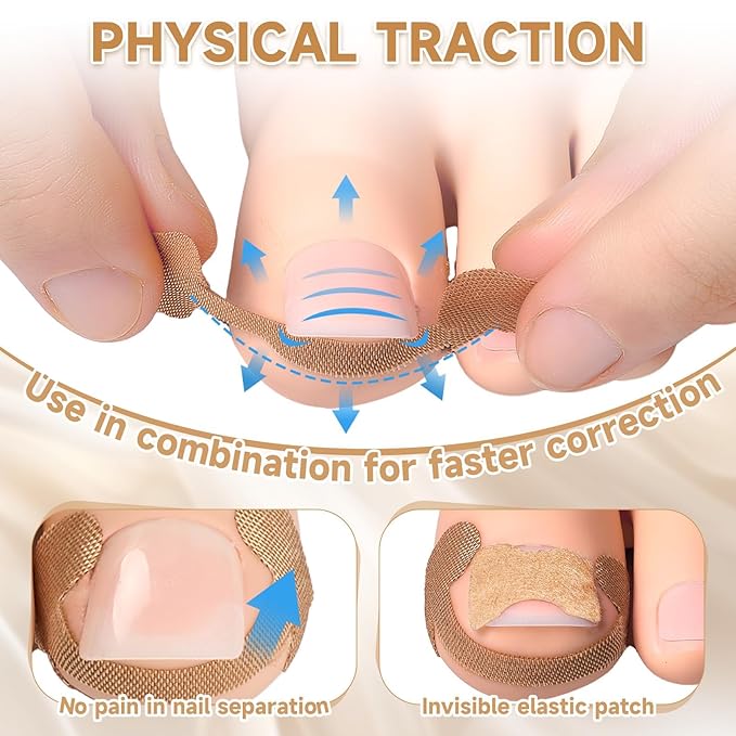 201 Pcs Ingrown Toenail Corrector Kit with Breathable Correction Strips, Curved Nail Patches, Toenail Lifter Tools, Complete Home Pedicure Set for Daily Nail Grooming & Nail Shaping