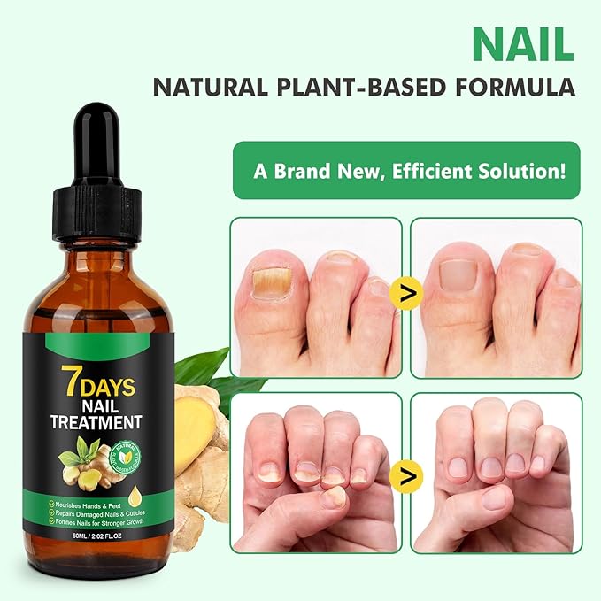 Ginger Nail Growth Serum,Ginger Cuticle Care Oil for Strengthen & Promote Nails Growth, Natural Plant Formula