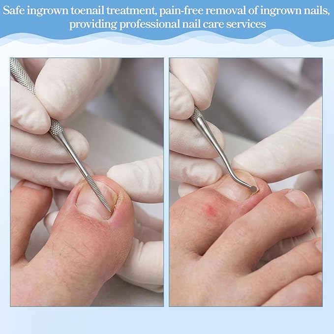 3 PCS Ingrown Toenail Removal Kit, Stainless Steel Pedicure Tools for Feet, Double Head Ingrown Toenail Cleaner Corrector Tool for Nail Cleaner Remove Dirt