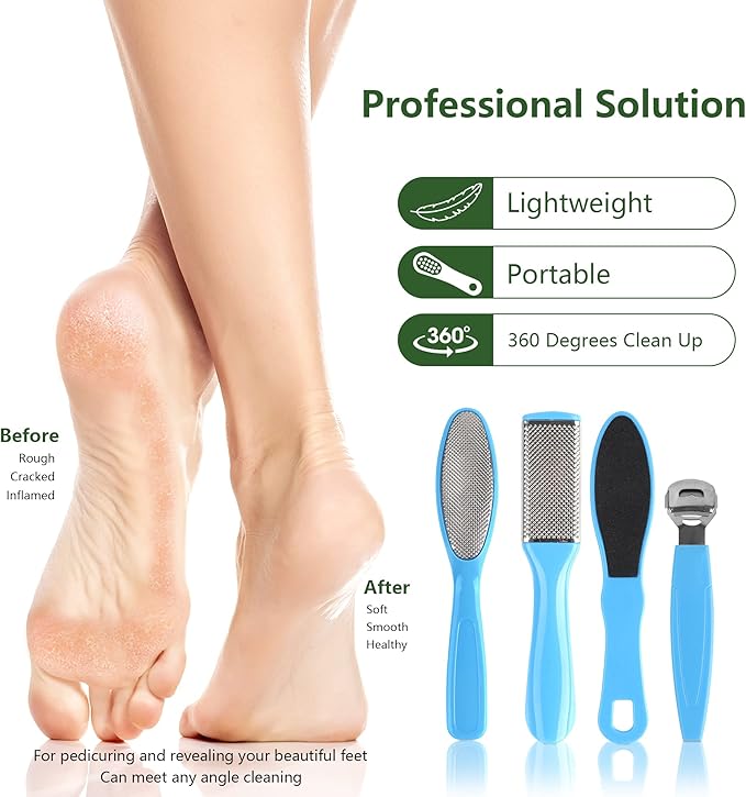 Professional Pedicure Tools Kit, 20 in 1 Stainless Steel Pedicure Foot Supplies Set, Foot Files Callus Dead Skin Remover, Pedicure Foot Spa Tools at Home or Salon for Women & Men(Blue)