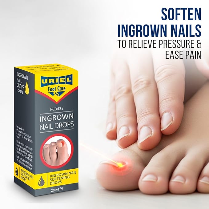 URIEL UPGRADED Ingrown Toenail Treatment, Ingrown Toenail Removal Kit, Ingrown Toenail Corrector, Ingrown Nail Kit Ingrown Toenail Tool 20ml